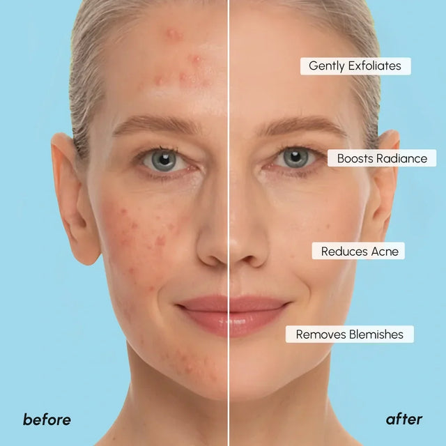 Skin Care