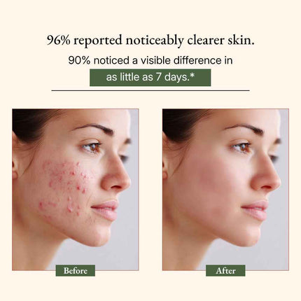 Ayurvedic Neem Soap Bar - Dashing Nova