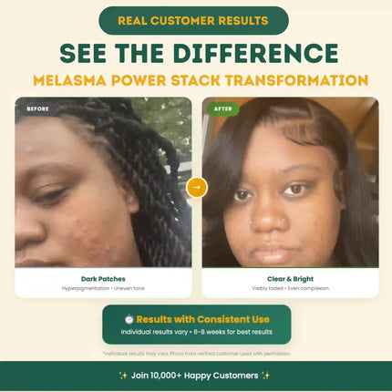 Melasma Power Stack - Dashing Nova