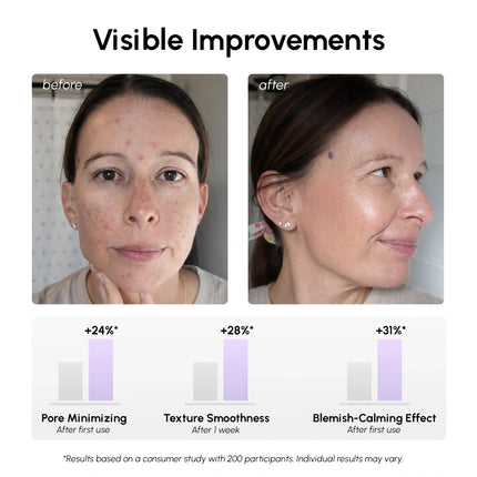 12% Niacinamide Smooth & Glow Pads - Dashing Nova