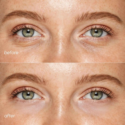 Pink Eye Patches for Puffy Eyes