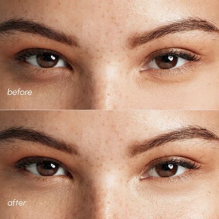 Pink Eye Patches for Puffy Eyes - Dashing Nova
