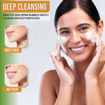 AMVital Turmeric Gel Cleanser - Dashing Nova