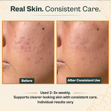 AMVital Turmeric Vitamin C Clay Mask - Dashing Nova