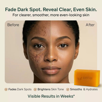 AMVital Turmeric Kojic Acid Soap Bar for Dark Spots & Uneven Tone - Dashing Nova