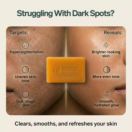 AMVital Turmeric Kojic Acid Soap Bar for Dark Spots & Uneven Tone - Dashing Nova